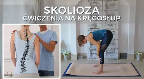 Skolioza: jakich ćwiczeń nie wykonywać, by uniknąć bólu i kontuzji